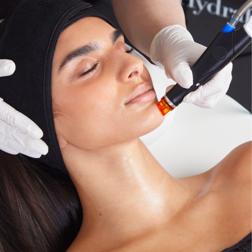 viva laser facial treatments